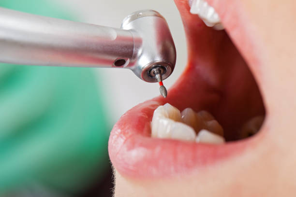 Best Emergency Dental Services for Seniors in Winfield, KS